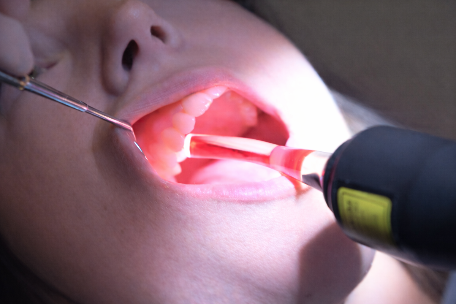 Ínysorvadás kezelési lehetőségei: APDT kezelés